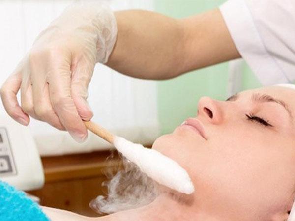 Лечение азотом кожи лица