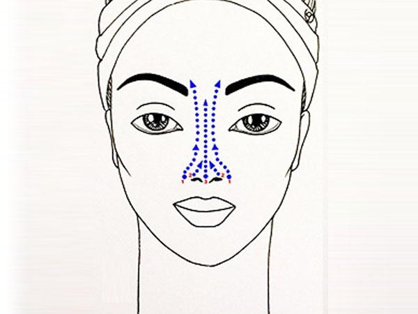 линии растяжения кожи лица картинка