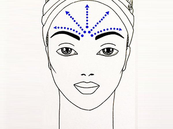 линии растяжения кожи лица картинка