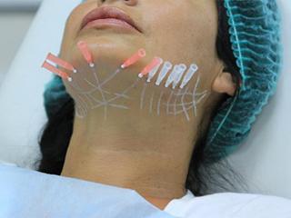 Армирование кожи лица гиалуроновой кислотой