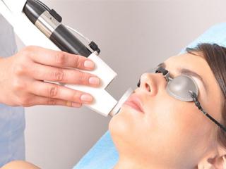 Лазерный пилинг для проблемной кожи лица