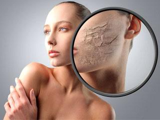 Можно ли делать химический пилинг лица для сухой кожи