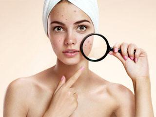 Как очистить кожу лица с помощью перекиси водорода