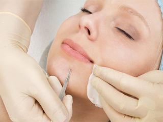 Очищение кожи лица у косметолога