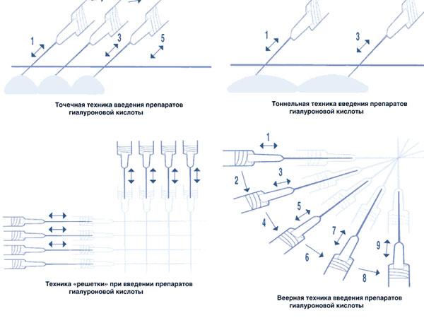 Rejeunesse shape для чего. 297 4643. Rejeunesse shape для чего фото. Rejeunesse shape для чего-297 4643. картинка Rejeunesse shape для чего. картинка 297 4643