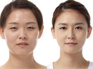 79 483 - Японский массаж для лица от морщин стань на 10 лет моложе